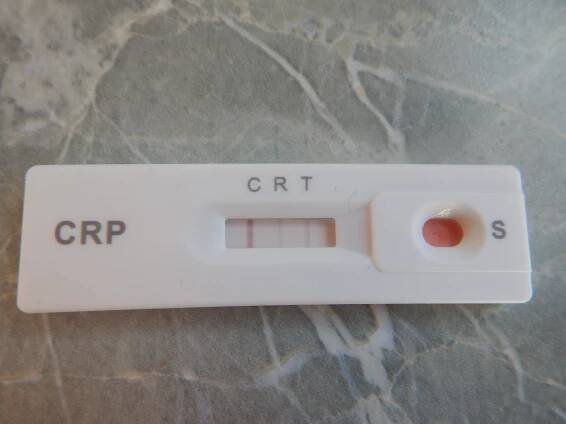 Zkušenosti domácí test CRP - Poradna pro ženy a dívky - WomenZone.cz 