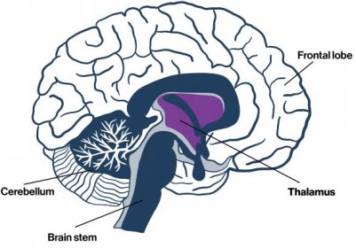 Diagram of brain.