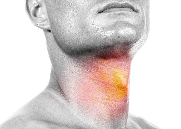 Head & Neck Cancer Awareness Month - American Academy of Otolaryngology-Head and Neck Surgery (AAO-HNS)