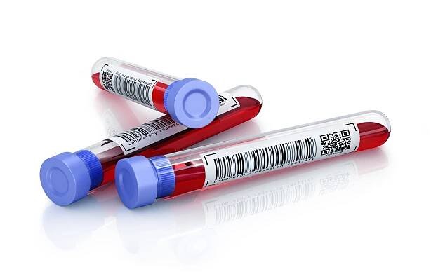 39805490 – medical test tubes isolated on white background