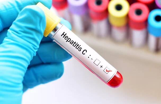Hepatitis C and HIV
