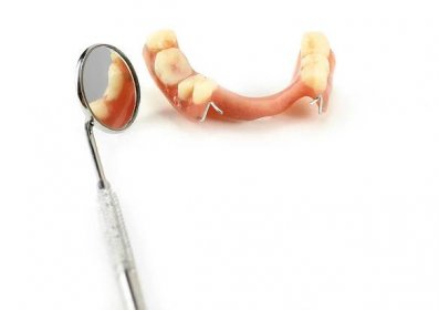 Částečná zubní protéza odráží v zubní zrcátko — Stock obrázek
