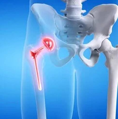 Total Hip Replacement Surgeons in Lucknow