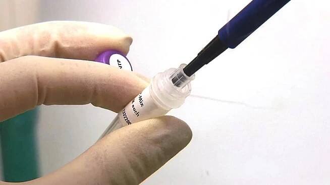 Nejsou jen dvě cukrovky, vědci nově popsali pět typů. Objev vysvětluje, proč někdy léčba nezabírala