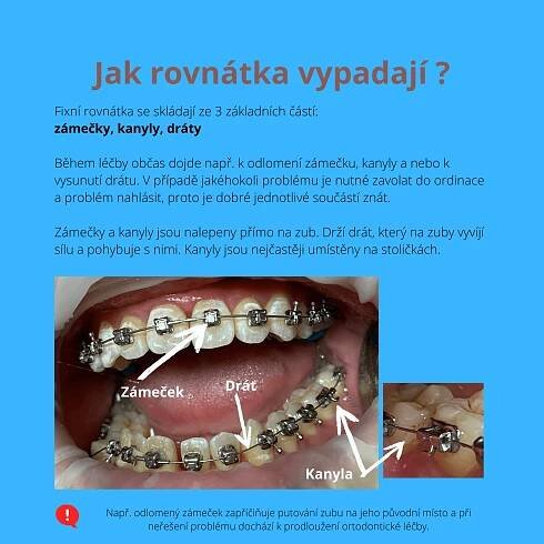 Dentální hygiena - Rovnátka Litoměřice