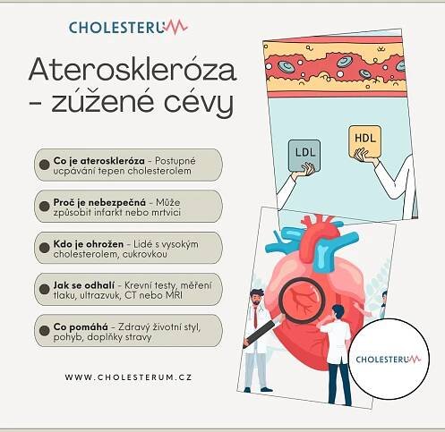 ateroskleróza infografika