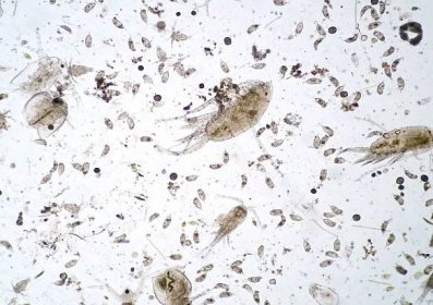sladkovodní vodní zooplankton pod mikroskopem - klanonožci - stock snímky, obrázky a fotky