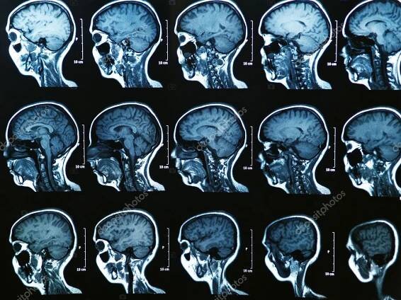 Stáhnout - MRI skenování lidského mozku — Stock obrázek