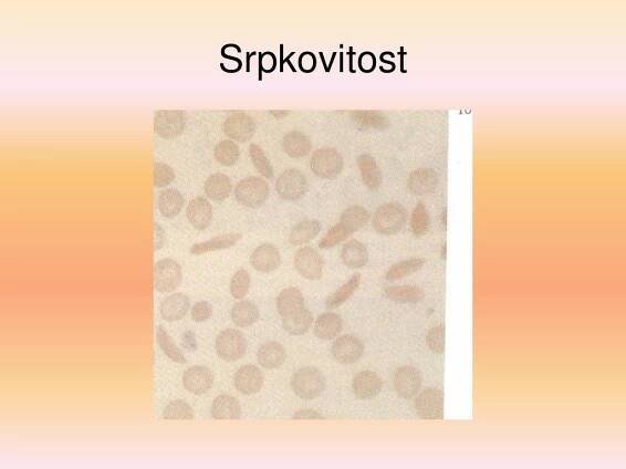 PPT - Nemoci krve a krvetvorných orgánů I PowerPoint Presentation, free download - ID:3739618