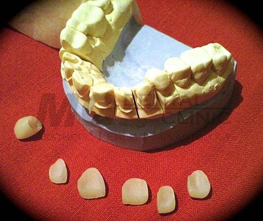 Clinical cases | MG Dental Clinic