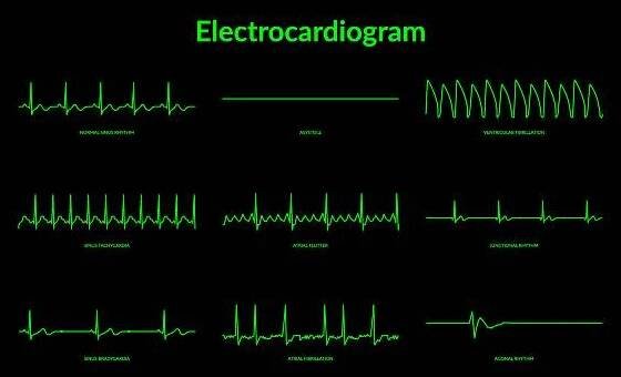 elektrokardiogram monitor srdečního tepu. vektor eps10 ilustrace - flutter síní stock ilustrace