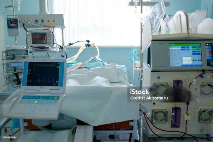 Nouzový pacient v kritickém stavu s intraaortickou balónkovou pumpou a mimotělním okruhem hemodialýzy - Bez autorských poplatků Jednotka intenzivní péče Stock fotka