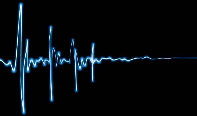 EKG - ECG line heartbeat rate graph