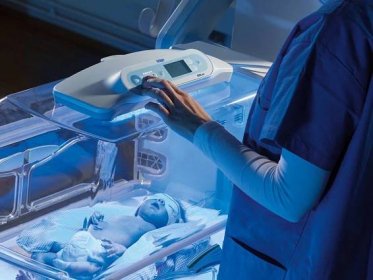 Baby is being treated for jaundice in the neonatal intensive care unit (NICU)