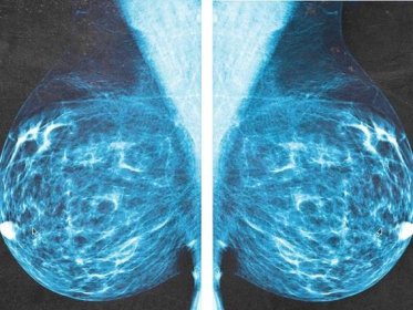Breast anatomy: Functions and how to check for breast cancer
