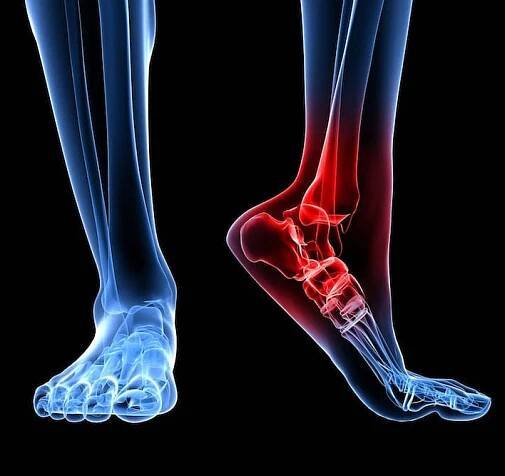 Foot & Ankle Trauma