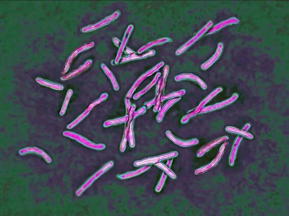 Mycobacterium tuberculosis