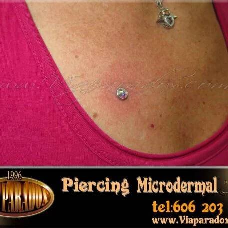 Microdermal - Via Paradox