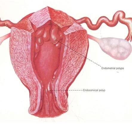 Polyps - Anthony Siow