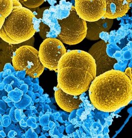  Defences . . . body's cells attack bacteria cells