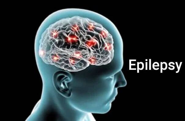 Světový den boje proti epilepsii: Lidé oblékají fialovou a podporují epileptiky po celém světě