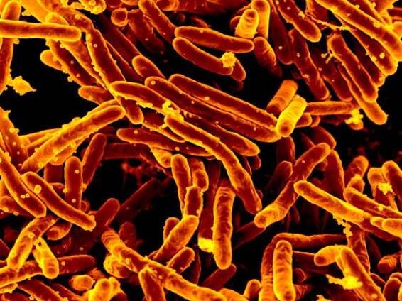 Vlastnosti Mycobacterium tuberculosis, morfologie, taxonomie, kultura / Biologie