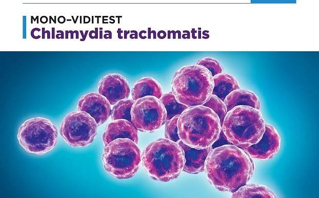 chlamydia trachomatis mono