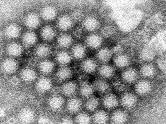 How To Avoid—and Prevent—the Norovirus That's on the Rise in the US
