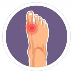 Artritida nohy poranění kloubu toe bolesti nebo kostra škody vektorové DNA nemoc ortopedický problém artritidy a revmatologie bolesti nebo bolesti otoky hyperurikémie a Artróza kostních onemocnění. — Ilustrace