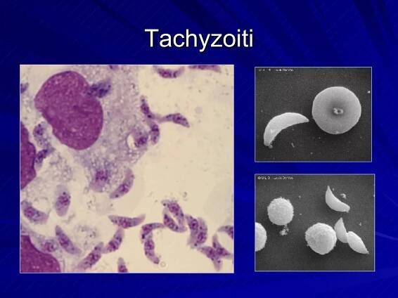 Tachyzoiti 