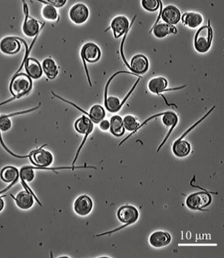 Soubor:Helicosporidium LM.png