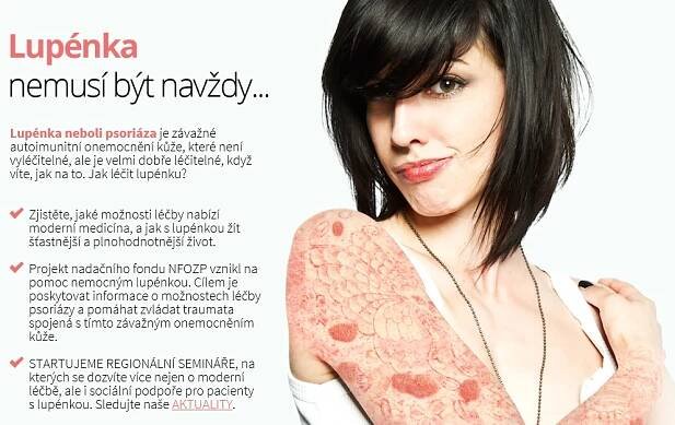 Počet lidí s lupénkou na biologické léčbě roste. Jen u VZP je jich za sedm let pětkrát víc
