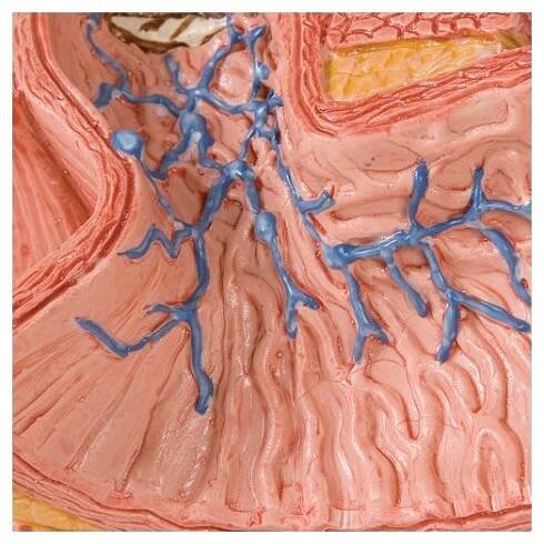 Model onemocnění lidského jícnu - oesophagus - patologické modely - modely lidské trávící soustavy