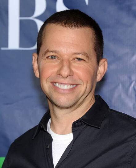 50 Celebrities Who Have Had Hair Transplants