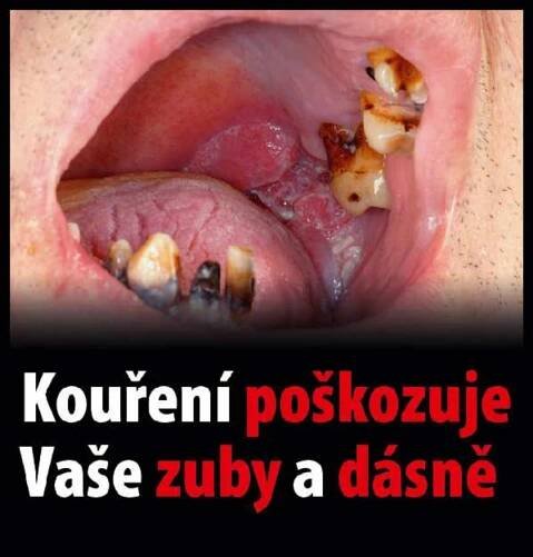 Varovné obrázky na krabičkách cigaret - 15 - GALERIE: Varovné obrázky na krabičkách cigaret (15/42)