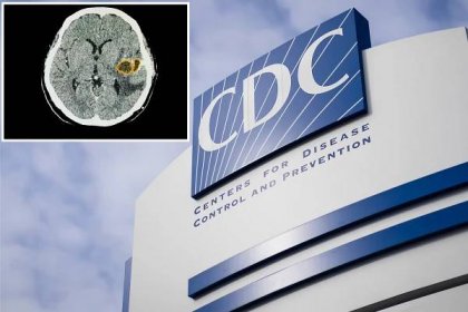 Doctors concerned over spike in potentially fatal brain infections in kids