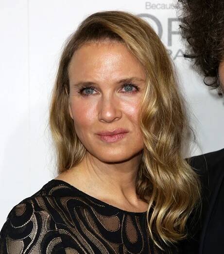 Photos of Renee Zellweger After Alleged Plastic Surgery