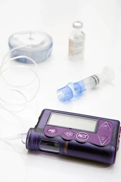 inzulínová pumpa, infuzní souprava a rezervoár - inzulínová pumpa - stock snímky, obrázky a fotky