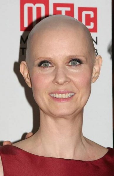 Cynthia Nixon: Sluší jí víc zrzavé kadeře, nebo holá lebka?
