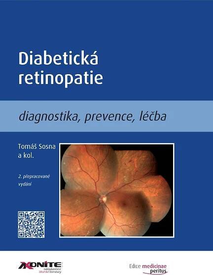 Diabetická retinopatie: Diagnostika, prevence, léčba - Tomáš Sosna od 429 Kč