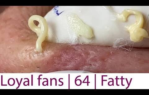 Acne Treatment Huong Da Nang# 064