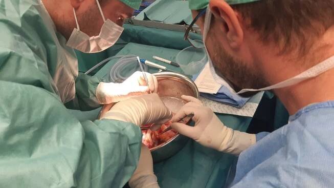 Úprava dárcovského orgánu před transplantací | foto: Andrea Skalická,  Český rozhlas