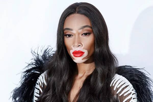 Supermodelka s vitiligem Winnie Harlow: Šikanu vystřídal úspěch a nyní boří stereotypy krásy