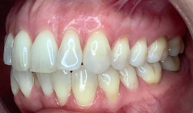 CandidPro - Clinical Capabilities Case Gallery