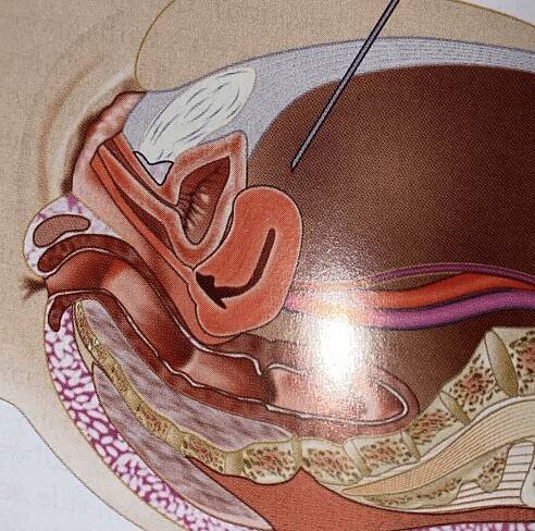 DaVinci Robotics Specialist - Alabama, Tennessee, and Texas: Elite IVF: Infertility and Reproductive Medicine