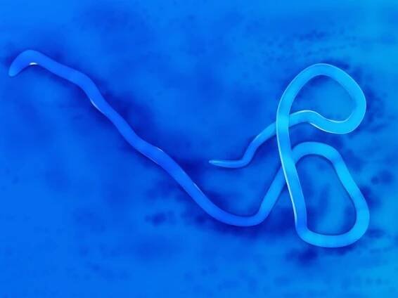 Ebola Leaves Unique Scar Inside Survivors' Eyes
