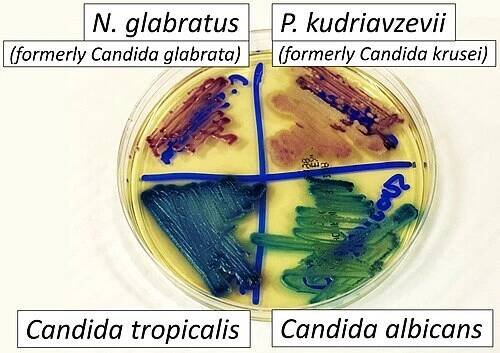 Candidiasis - Wikipedia