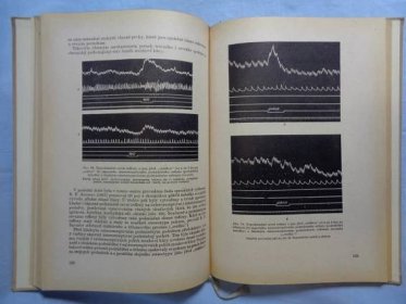 Kortikoviscerální theorie pathogenese vředové choroby , 1955