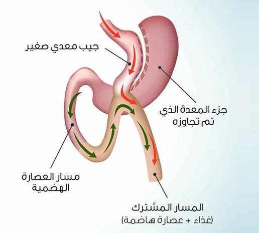 تحويل المسار | الموقع الرسمي - البروفيسور عائض القحطاني