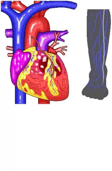 Coronary Bypass (Heart and Leg View) – Cardiovascular System